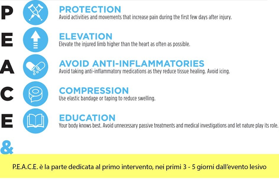 Immagine distorsione caviglia